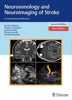 NEUROSONOLOGY AND NEUROIMAGING OF STROKE:A COMPREHENSIVE REF