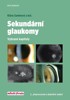 SEKUNDÁRNÍ GLAUKOMY - VYBRANÉ KAPITOLY  2.VYDÁNÍ