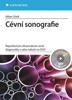 CÉVNÍ SONOGRAFIE-REPETITORIUM ULTRAZVUKOVÉ CÉVNÍ DIAGNOSTIKY