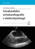INTRAKARDIÁLNÍ ECHOKARDIOGRAFIE V ELEKTROFYZIOLOGII