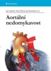 AORTÁLNÍ NEDOMYKAVOST