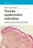 TOXICKÁ EPIDERMÁLNÍ NEKROLÝZA V KONTEXTU ZÁVAŽNÝCH BULÓZNÍCH