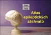 ATLAS EPILEPTICKÝCH ZÁCHVATŮ