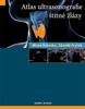 ATLAS ULTRASONOGRAFIE ŠTÍTNÉ ŽLÁZY