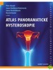 ATLAS PANORAMATICKÉ HYSTEROSKOPIE