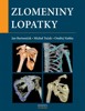 ZLOMENINY LOPATKY