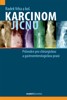 KARCINOM JÍCNU - PRŮVODCE PRO CHIRURGICKOU A GASTROENT.PRAXI