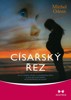 CÍSAŘSKÝ ŘEZ-CO JE DOBRÉ VĚDĚT O CÍSAŘSKÉM ŘEZU