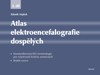 ATLAS ELEKTROENCEFALOGRAFIE DOSPĚLÝCH 3.DÍL