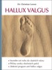 HALLUX VALGUS